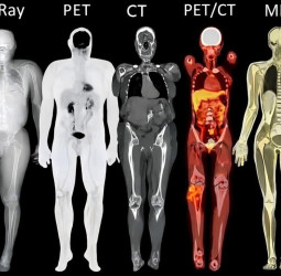 மருத்துவ இமேஜிங் பரிசோதனைகள் ஏன் மாறுபடுகின்றன?