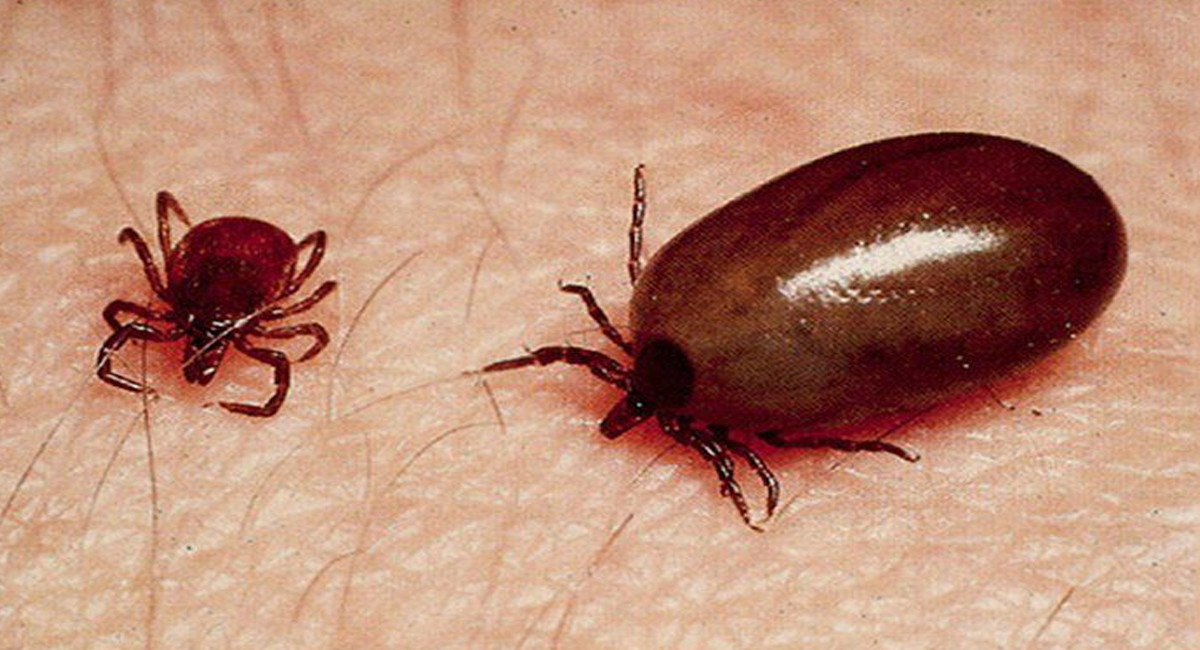 மர்மக் காய்ச்சலாக அச்சுறுத்தும் உண்ணி காய்ச்சல் (Scrub Typhus): அறிகுறிகள், காரணங்கள் மற்றும் தற்காப்பு முறைகள்!